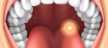 Understanding Cementum: The Unsung Hero of Your Teeth