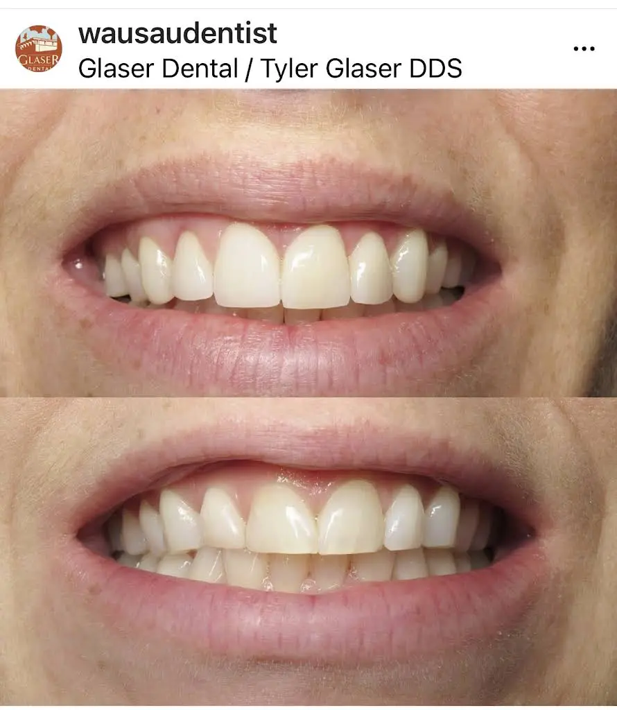 Glaser Dental