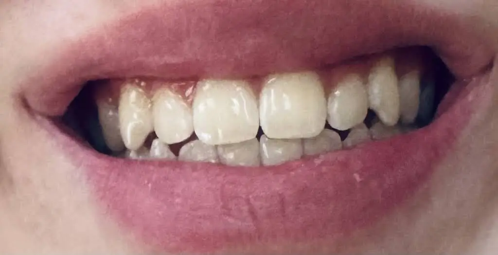 Gorgeous Smile
