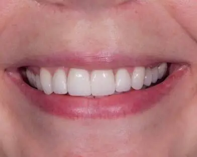 JLM Dental Studios - Professional dental clinic exterior with modern facilities