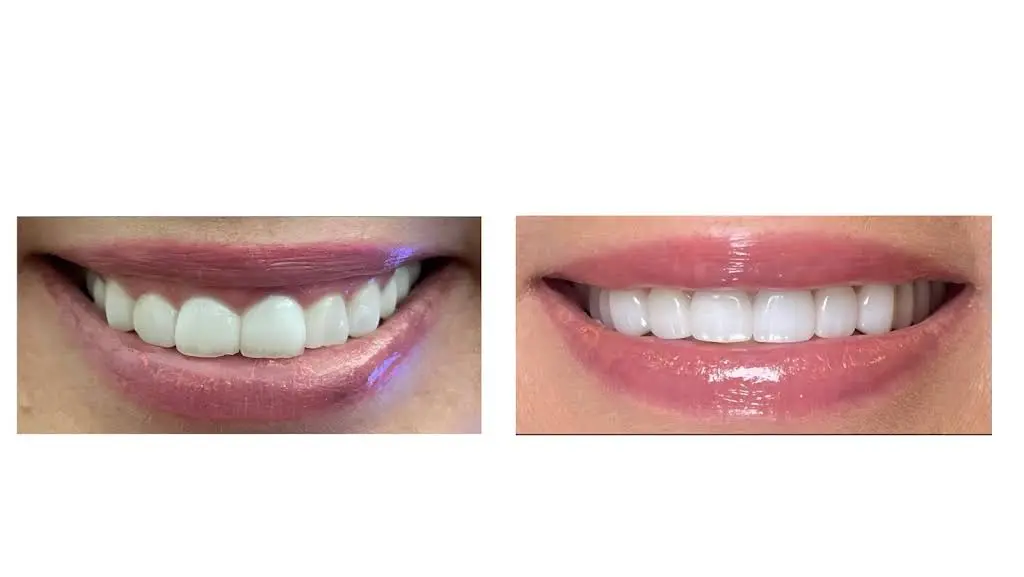 Buckhead Dental Center - Professional dental clinic exterior with modern facilities