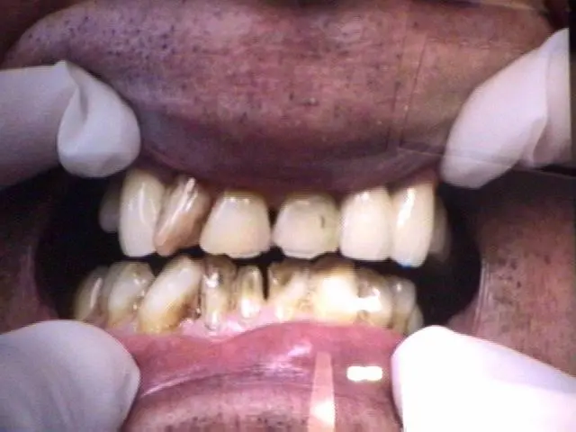 Rotterdam Family Dentistry Anthony Bogdan DDS - Professional dental clinic exterior with modern facilities
