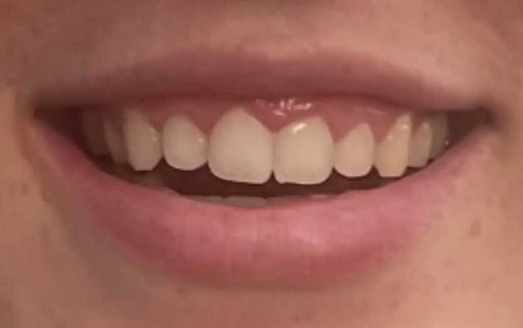 My Gum Doc
