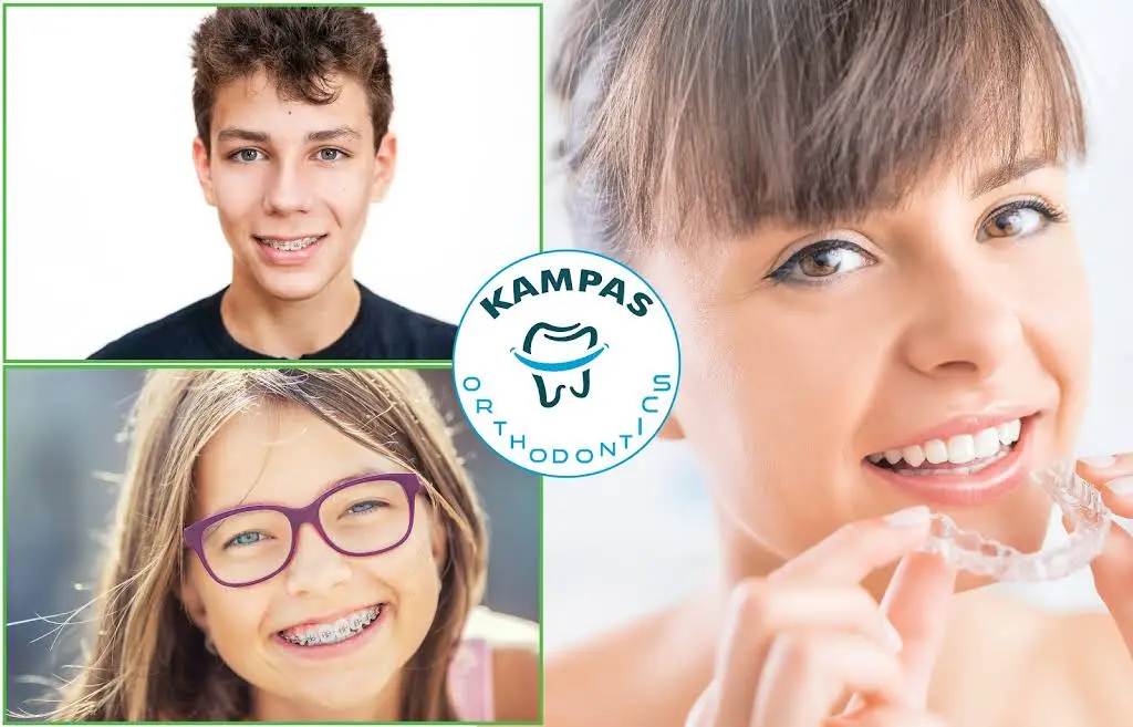 Kampas Orthodontics