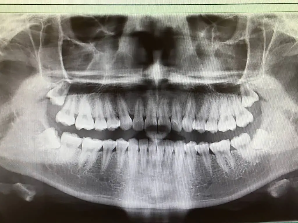 Hester Dental - Bruce A. Hester DMD