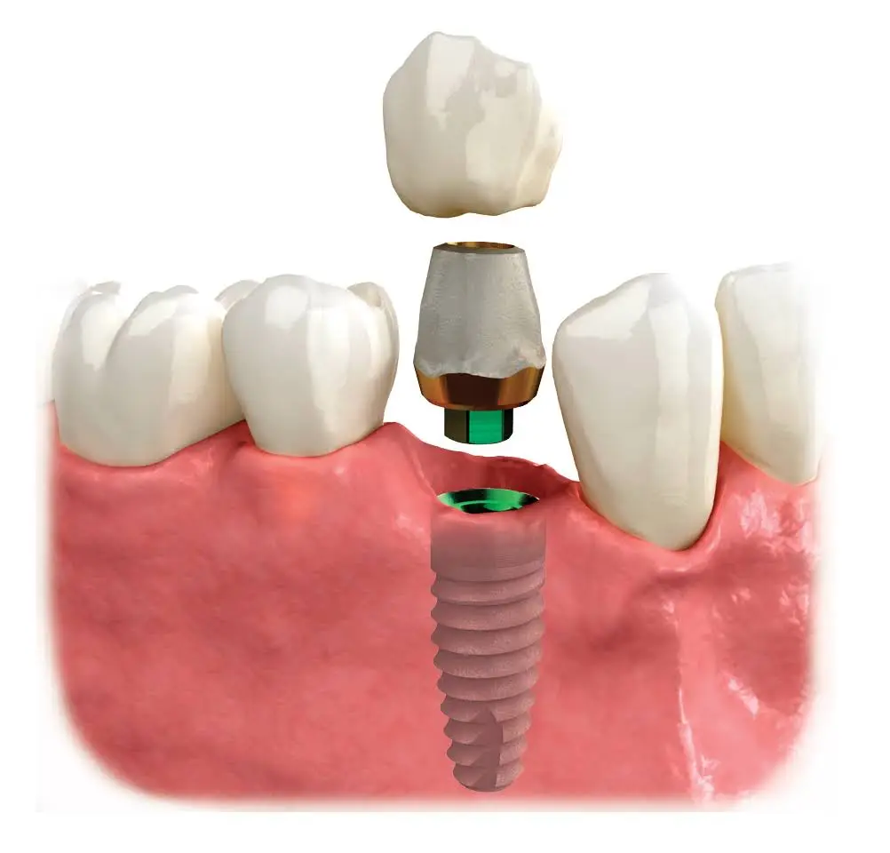 Jan P. Fugal DDS