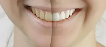Saratoga Family Dentistry