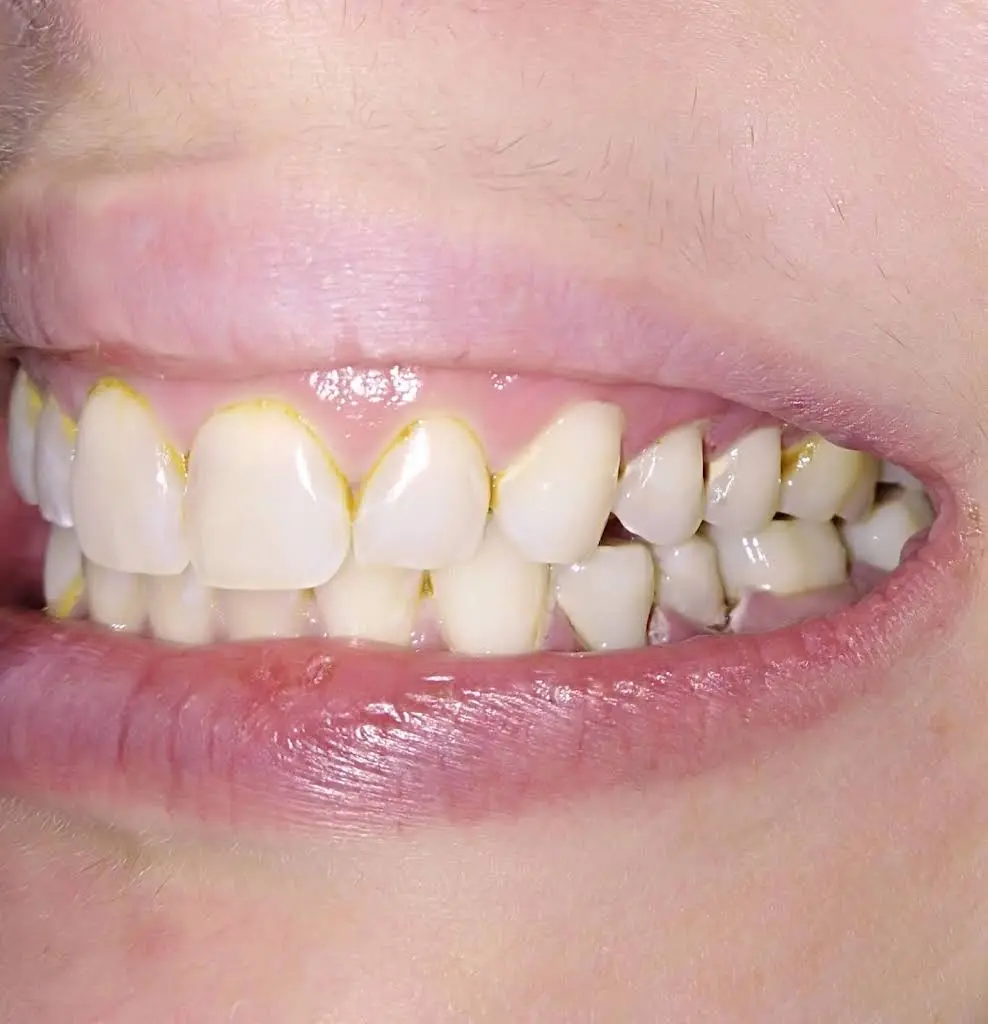 Perfect Image Dental Associates