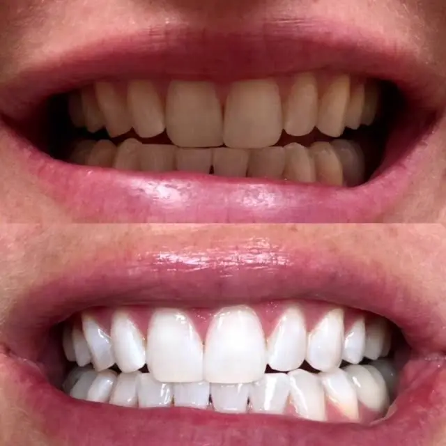 Johns Creek Dentistry - Dr. Daniel Choi, DDS