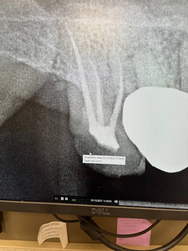Aspen Dental
