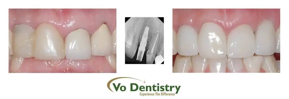 Vo Dentistry