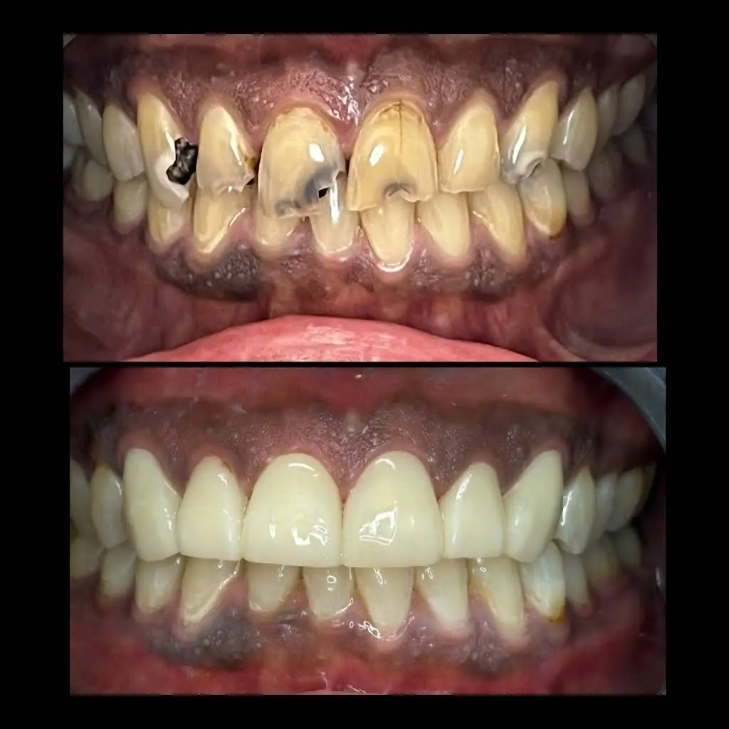 Desert Palms Dental - Professional dental clinic exterior with modern facilities