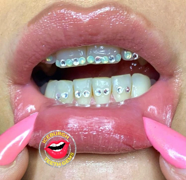 IceBurgh Teeth Gems - Professional dental clinic exterior with modern facilities