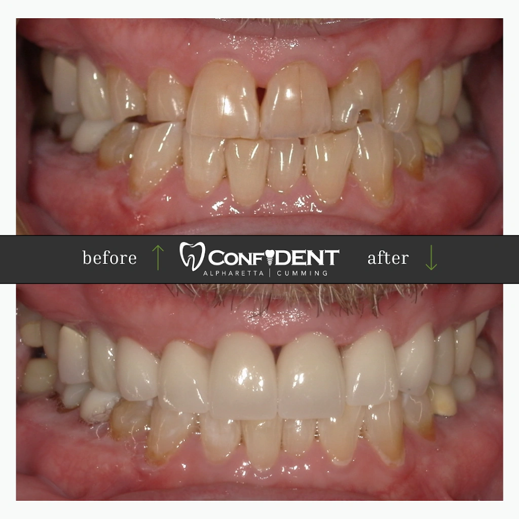 ConfiDENT Dental - Professional dental clinic exterior with modern facilities