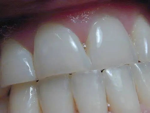 Alpenglow Dental - Professional dental clinic exterior with modern facilities