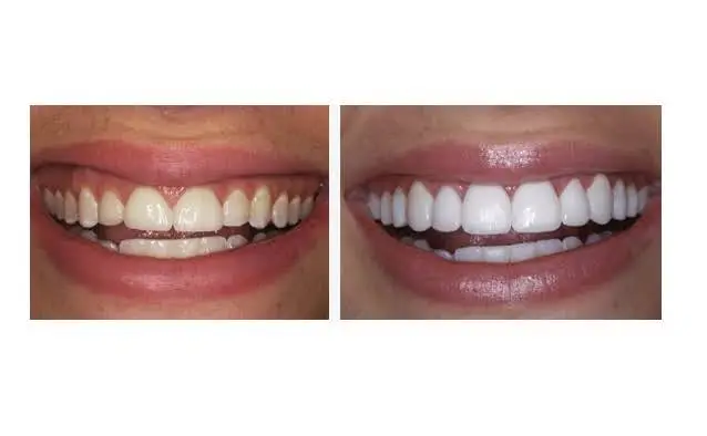 Young Family Dental - Professional dental clinic exterior with modern facilities