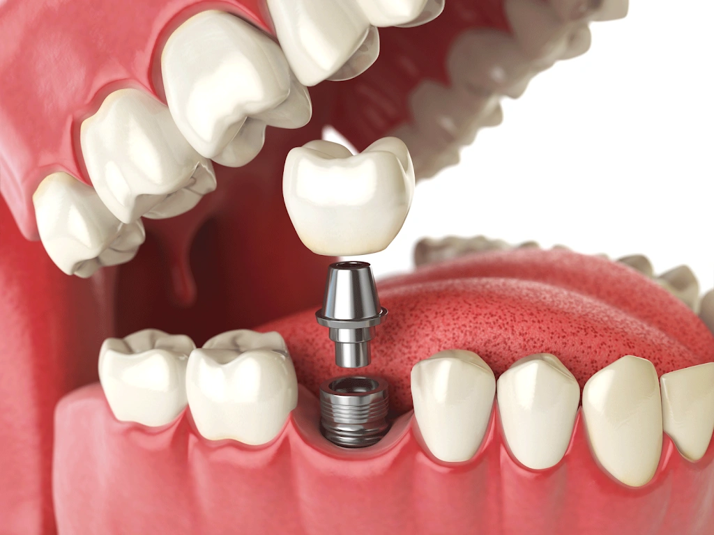 Now Dentures and Implants - Professional dental clinic exterior with modern facilities
