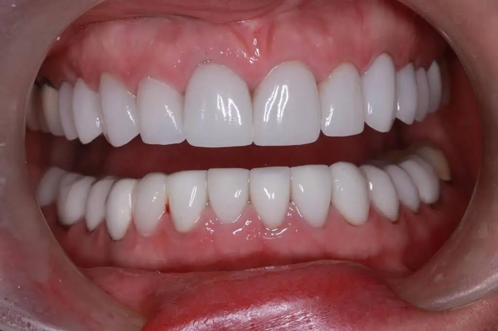 Weller Dental