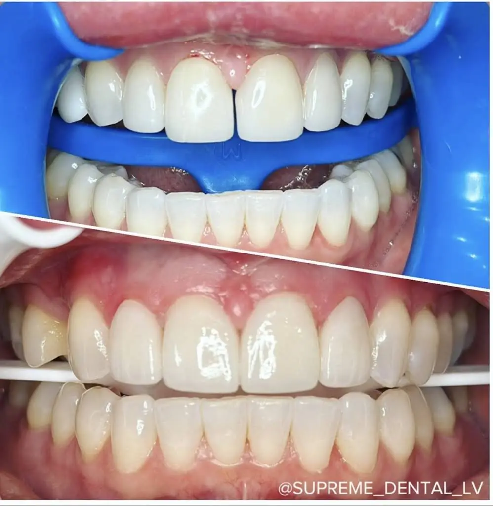 Supreme Dental - Professional dental clinic exterior with modern facilities