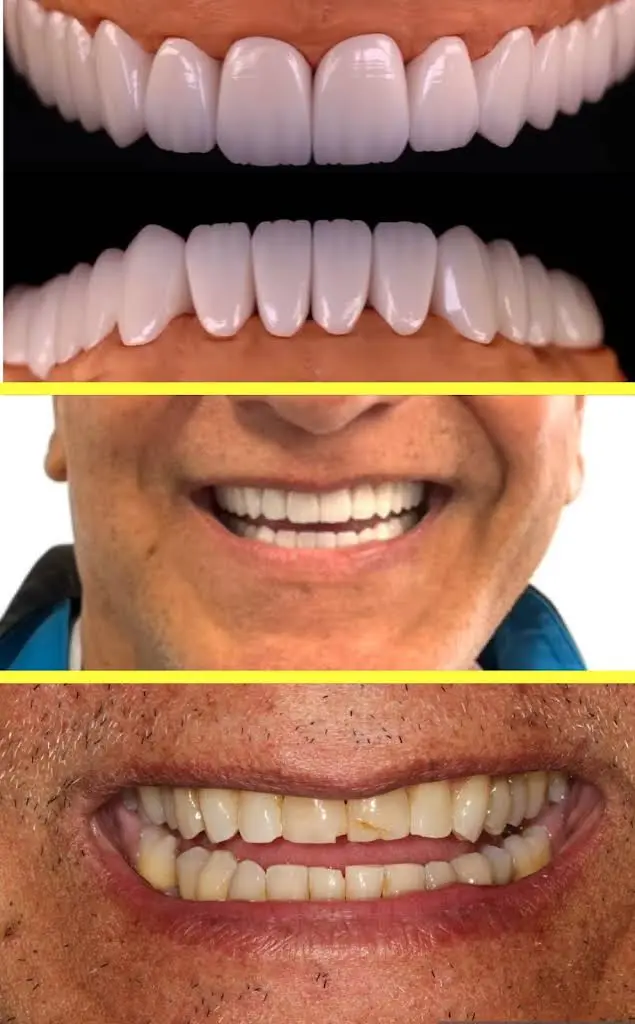 Makeover Dental