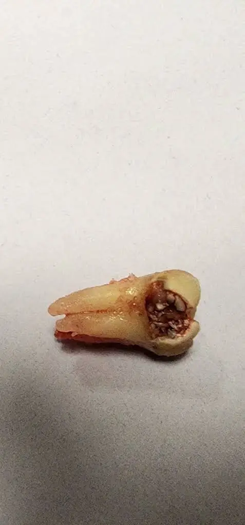 Aspen Dental