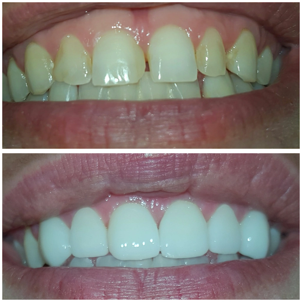 Ace Dental Center - Professional dental clinic exterior with modern facilities