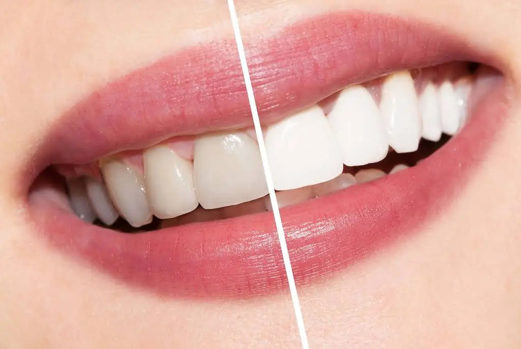 Inspire Dental of Summerlin - Professional dental clinic exterior with modern facilities