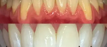We Whiten