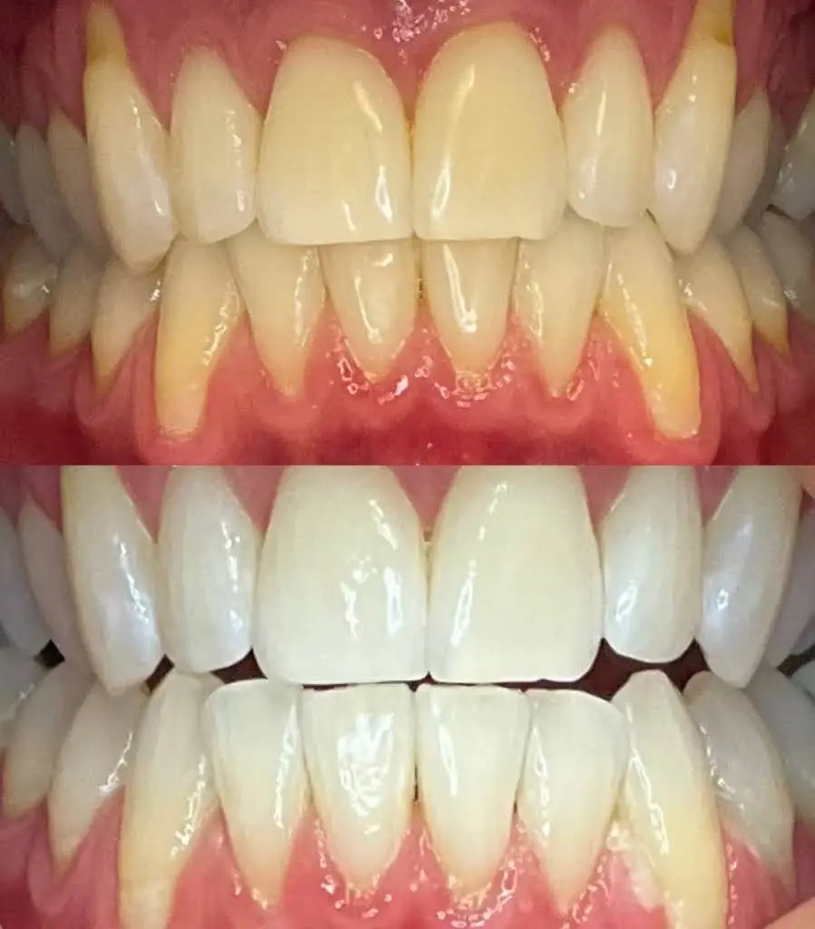 We Whiten - Professional dental clinic exterior with modern facilities