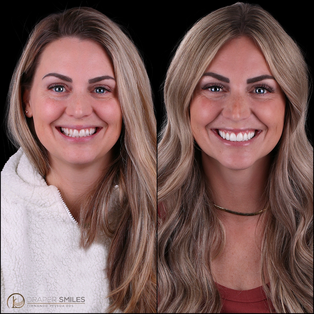 Draper Smiles - Dr. Fernando Pessoa - Professional dental clinic exterior with modern facilities