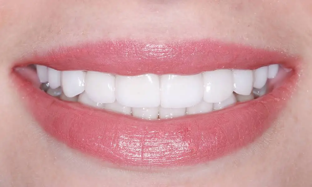 Elite Smiles by Walter Meden DDS - Professional dental clinic exterior with modern facilities