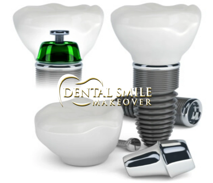 Dental Smile Makeover - Professional dental clinic exterior with modern facilities