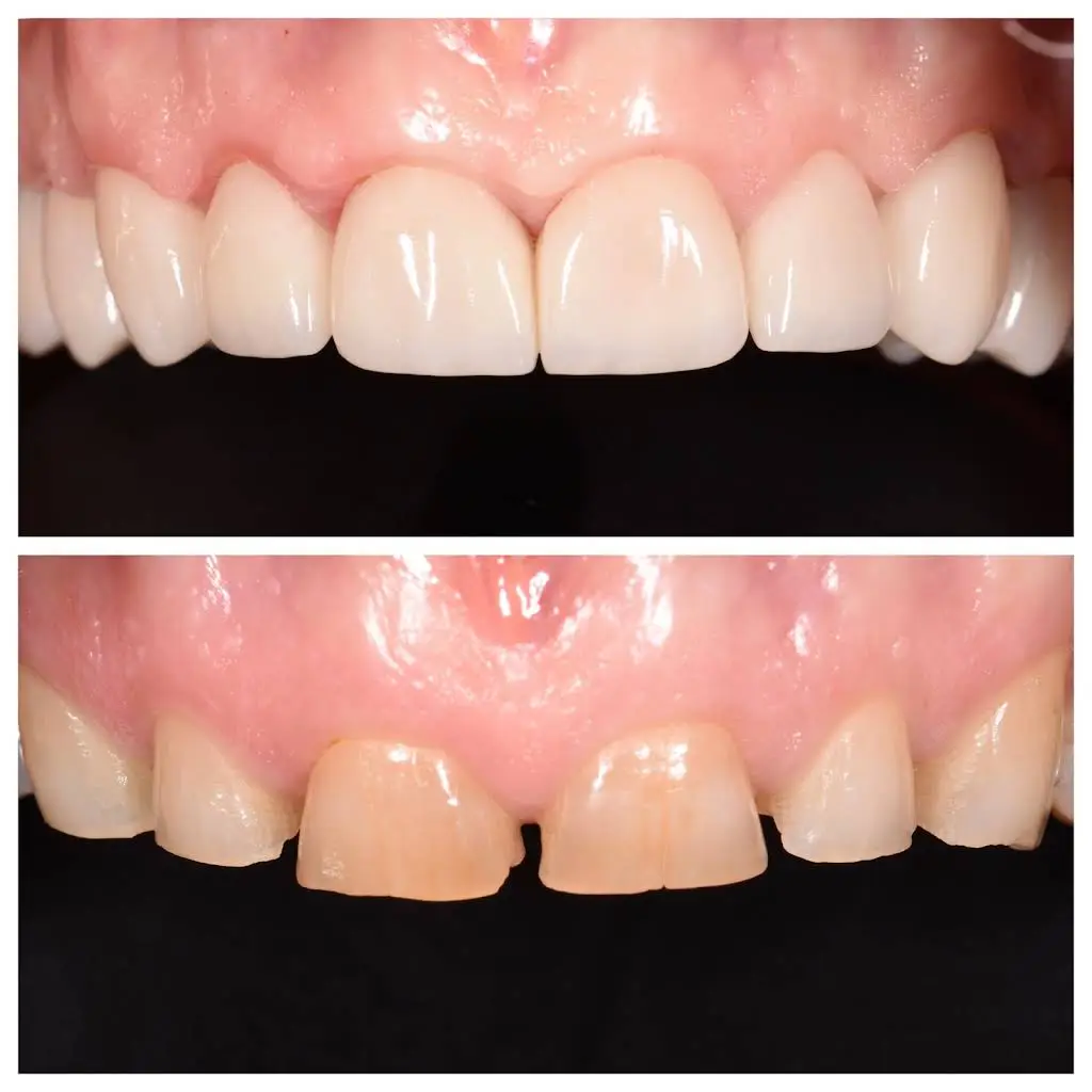 Healthy Smiles Dental - Las Vegas Dentist