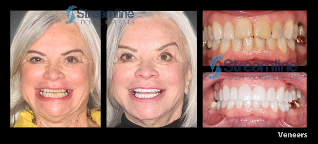 Dentistry For Children