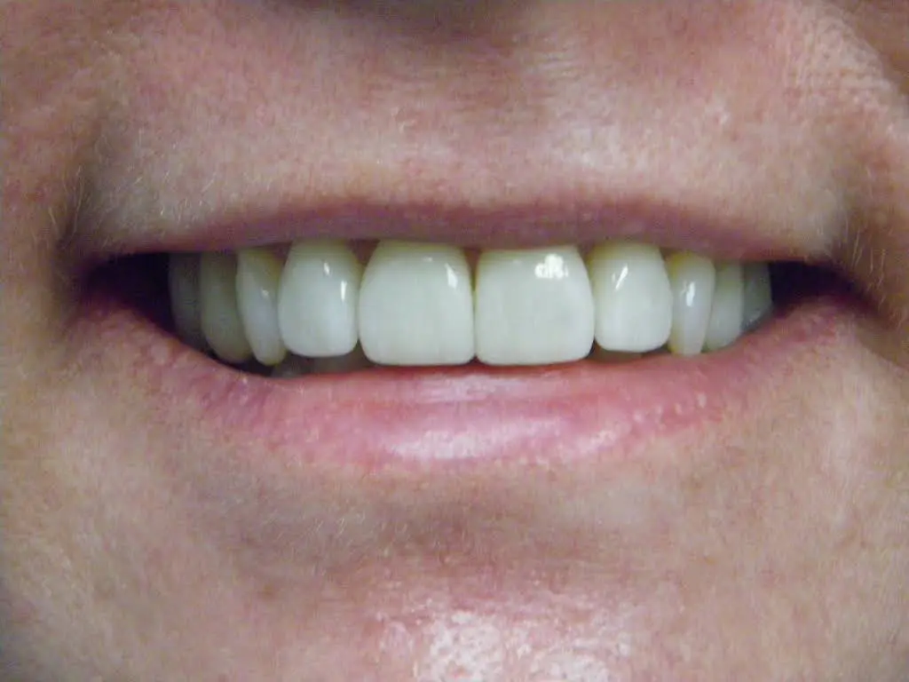 Arlington Comfort Dental