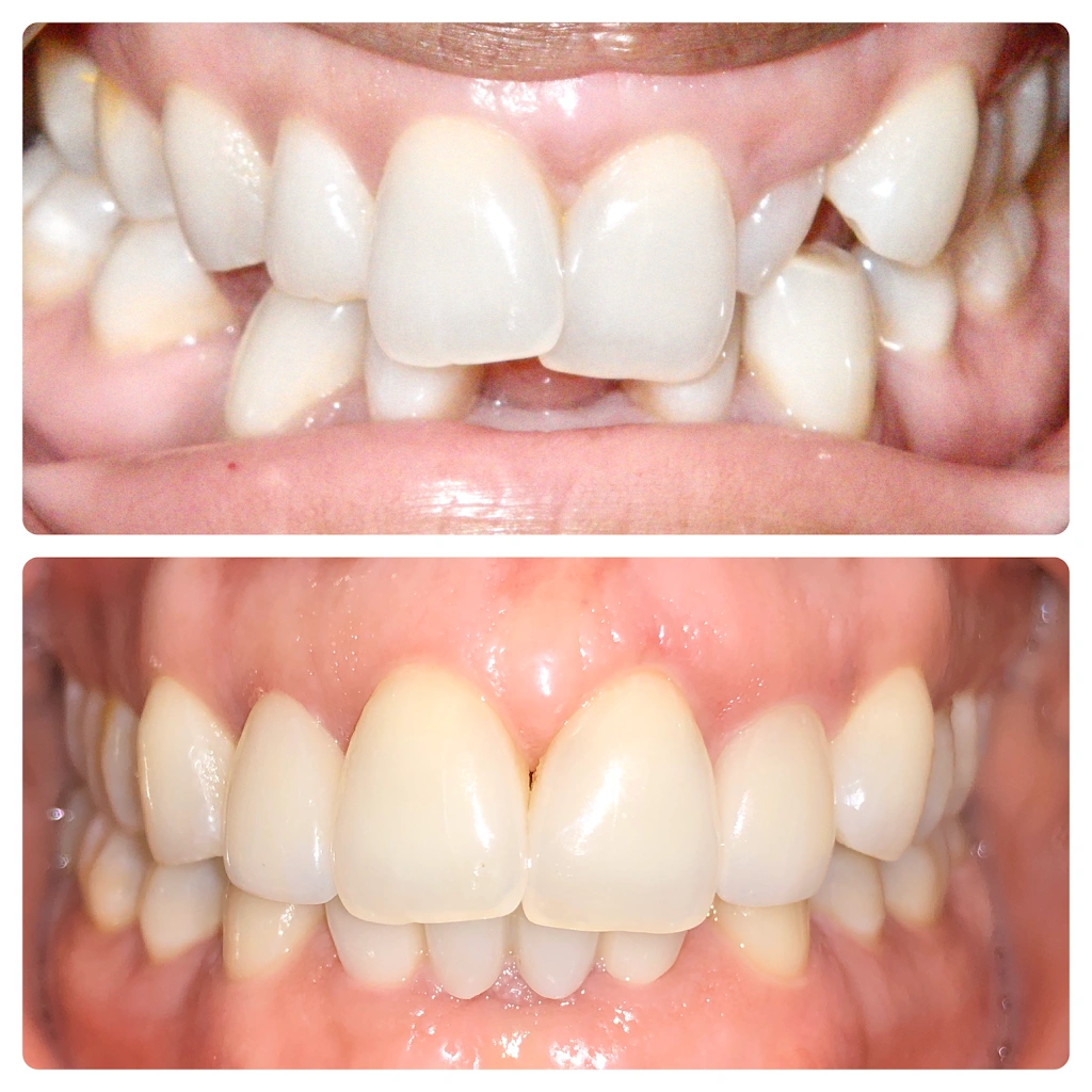 Pineview Dental Care