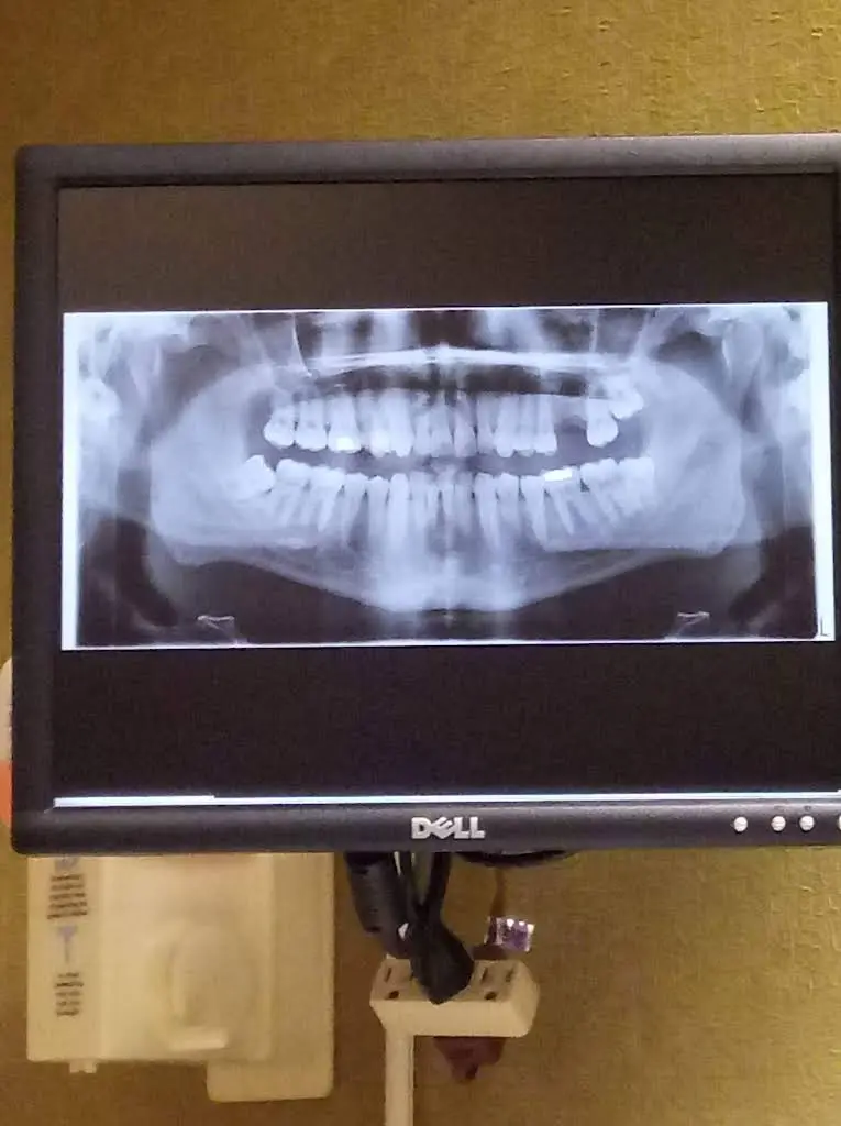 All Family Dental and Braces