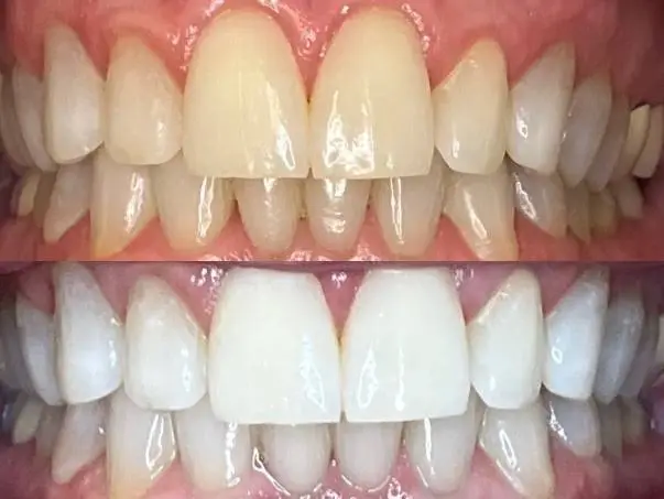 We Whiten Teeth Whitening - Professional dental clinic exterior with modern facilities