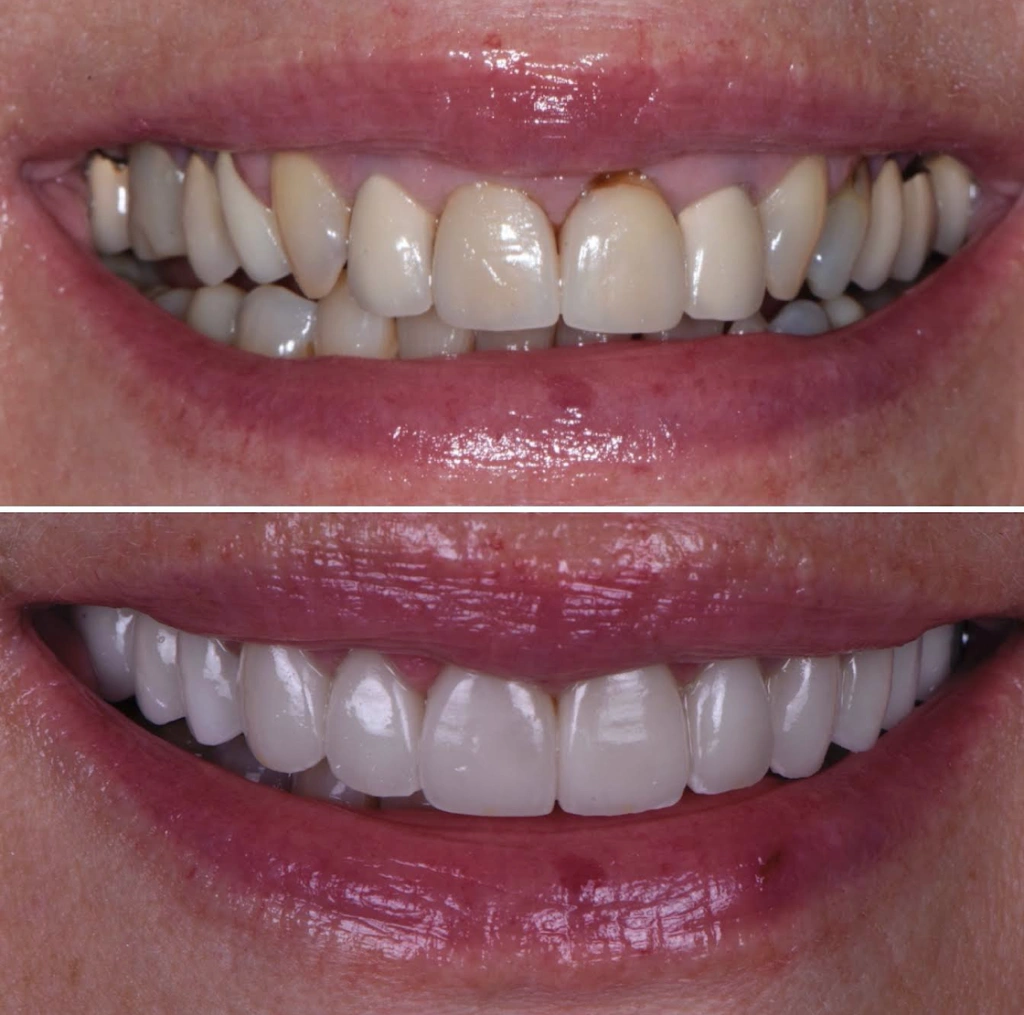 Las Vegas Aesthetic Dentistry - Professional dental clinic exterior with modern facilities
