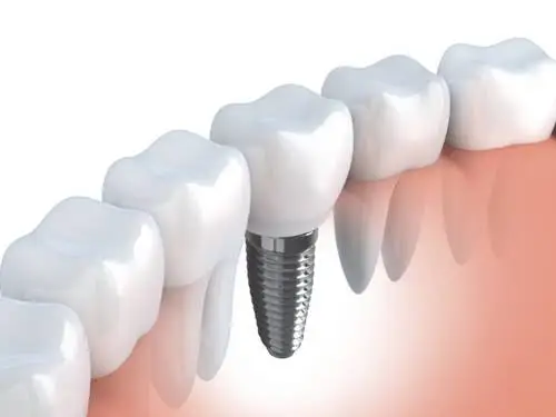 Neu Family Dental