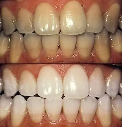 Neu Family Dental