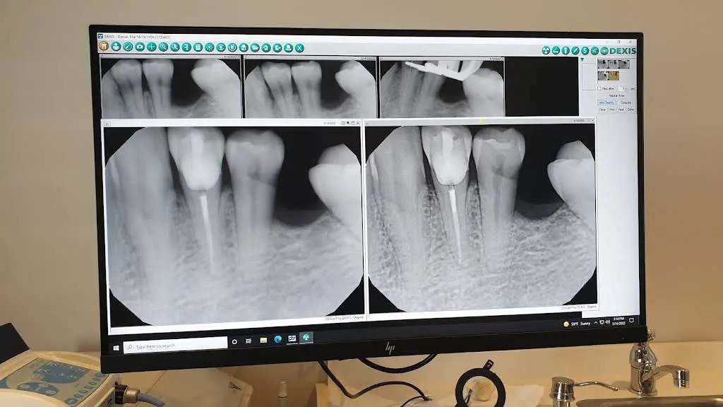 Illinois Valley Endodontics, Dr. Lee Ceresa D.D.S. - Professional dental clinic exterior with modern facilities