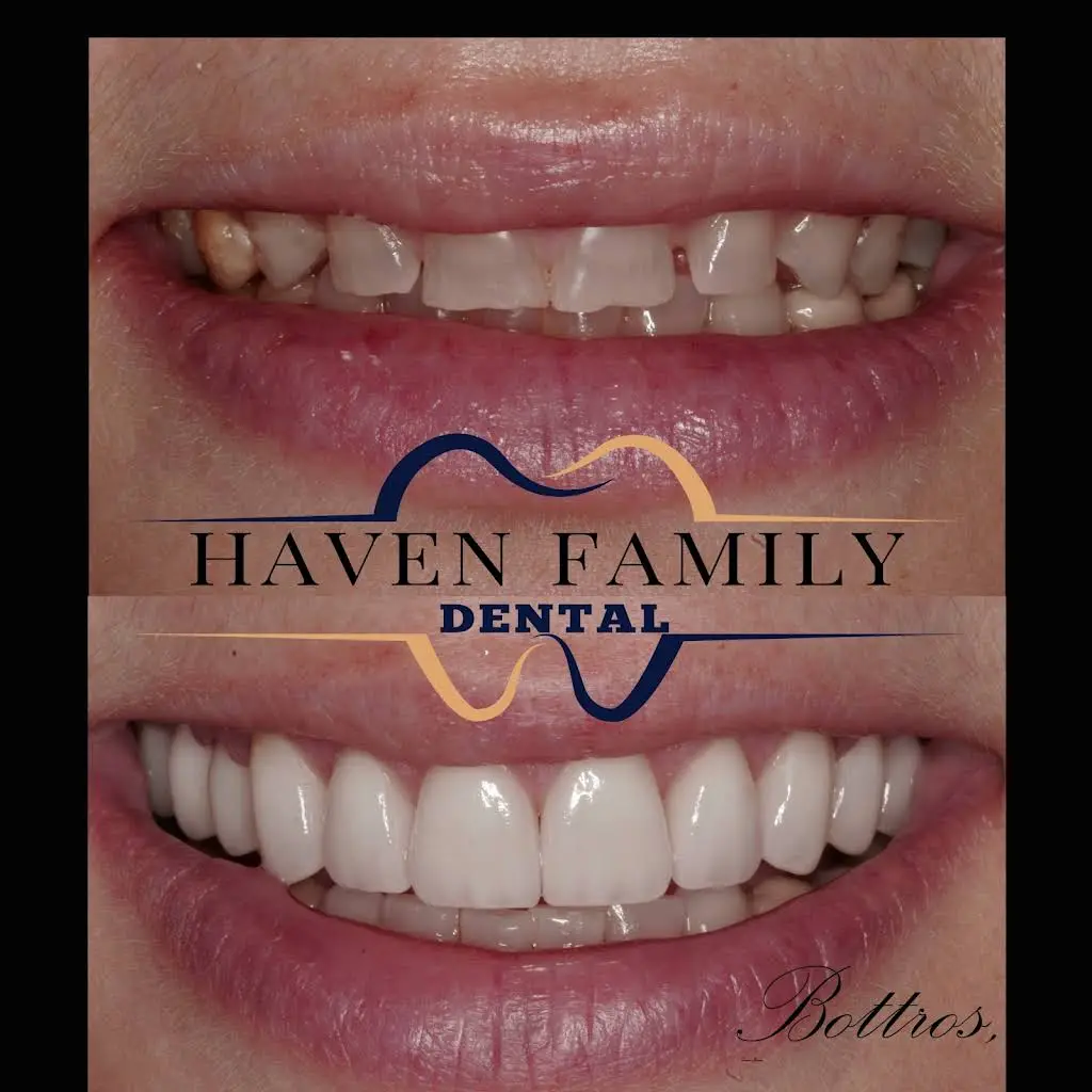 Haven Family Dental - Dr. Bottros - Professional dental clinic exterior with modern facilities