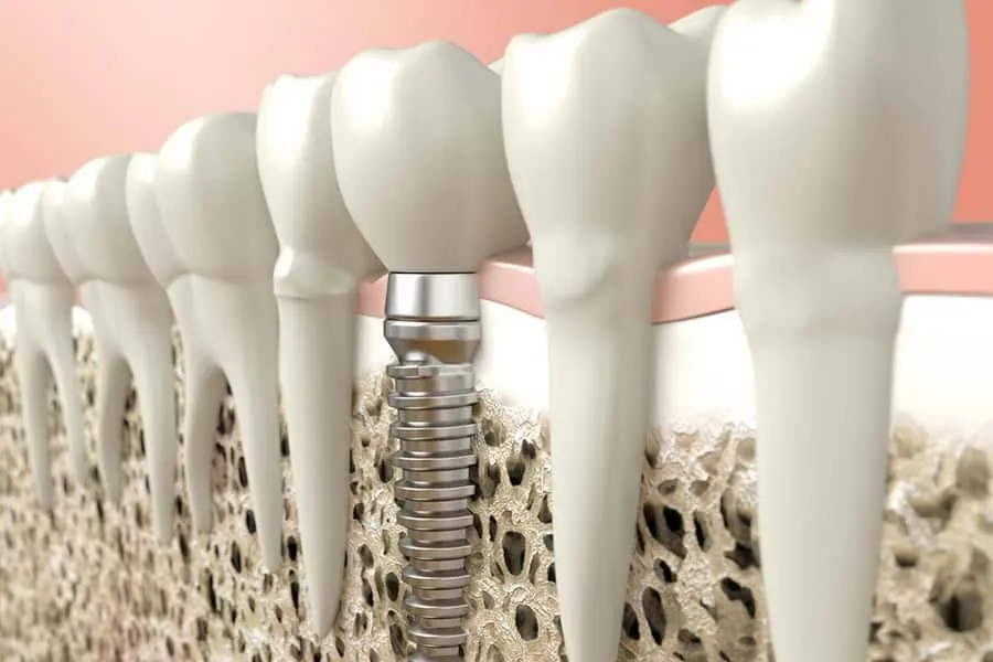Innovative Periodontics & Implants: Donald G Flynn, DDS