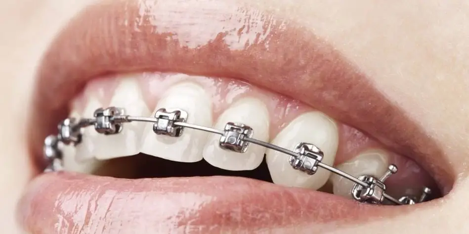 Young Family Dental American Fork