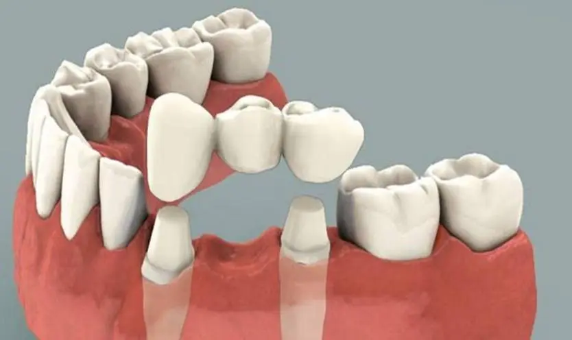 Young Family Dental American Fork