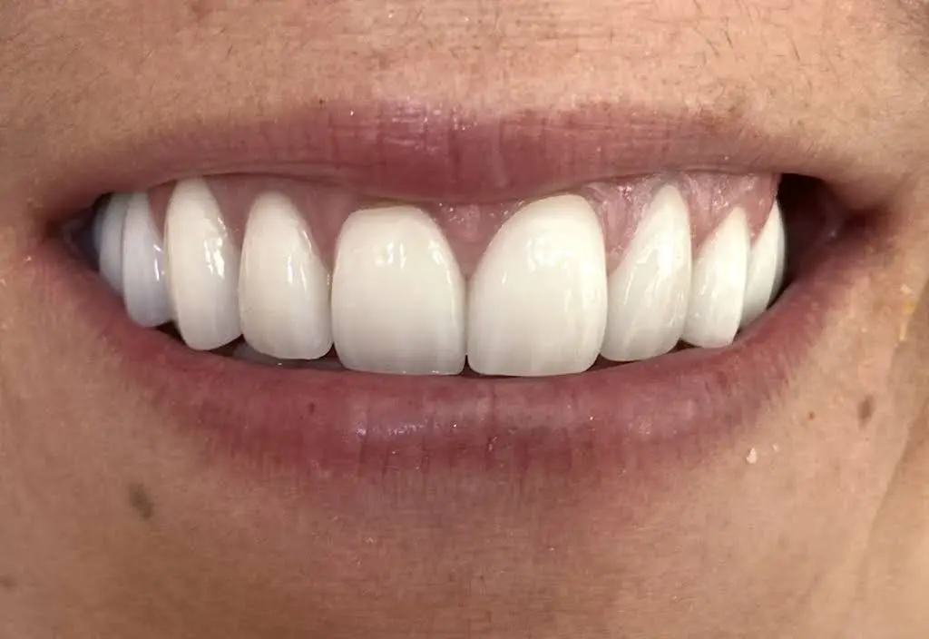Utah Valley Dental
