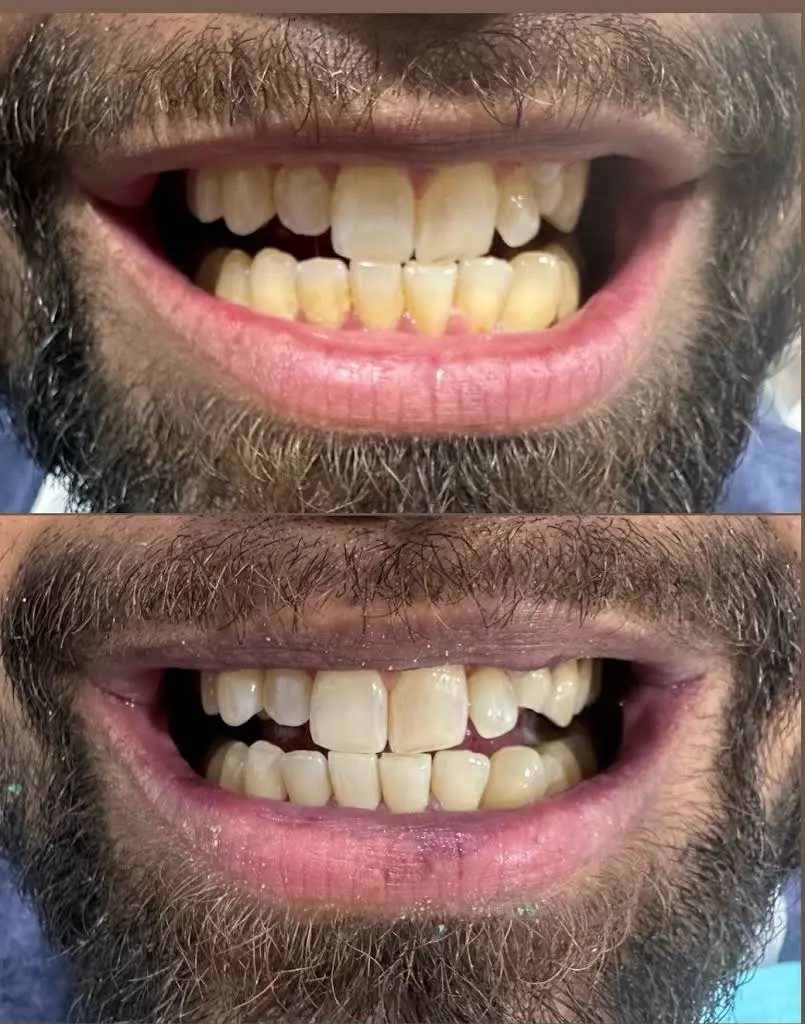 Bliss Dental