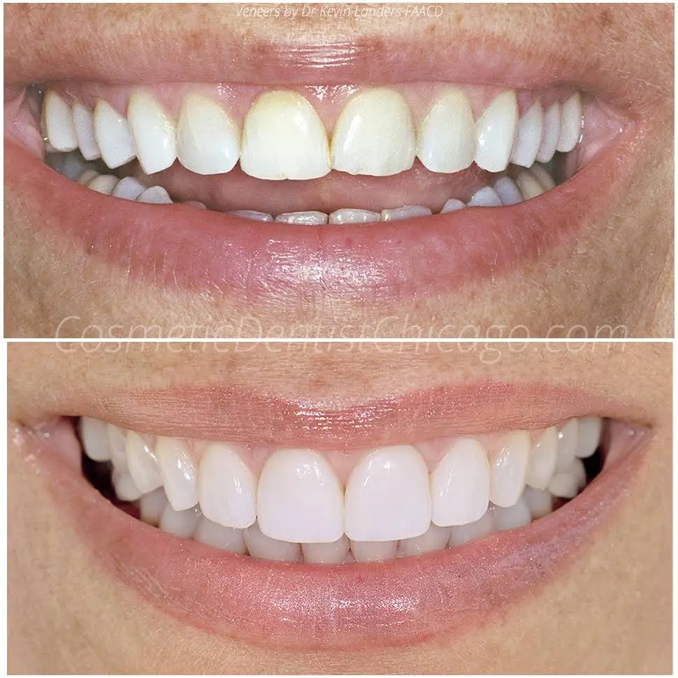 Advanced Cosmetic & Implant Dentistry