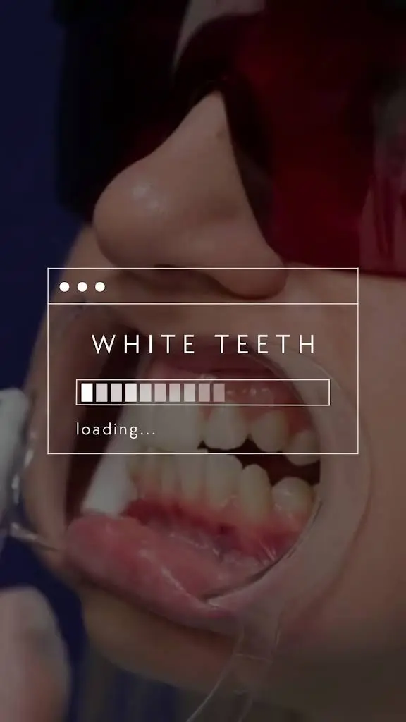 Pure White Smiles And Gems